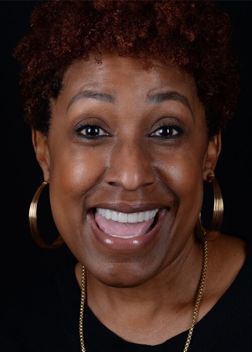 Before and after dental treatment at Wylie Dentistry Co.