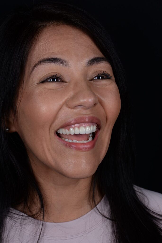 Smiling patient of Wylie Dentistry Co.